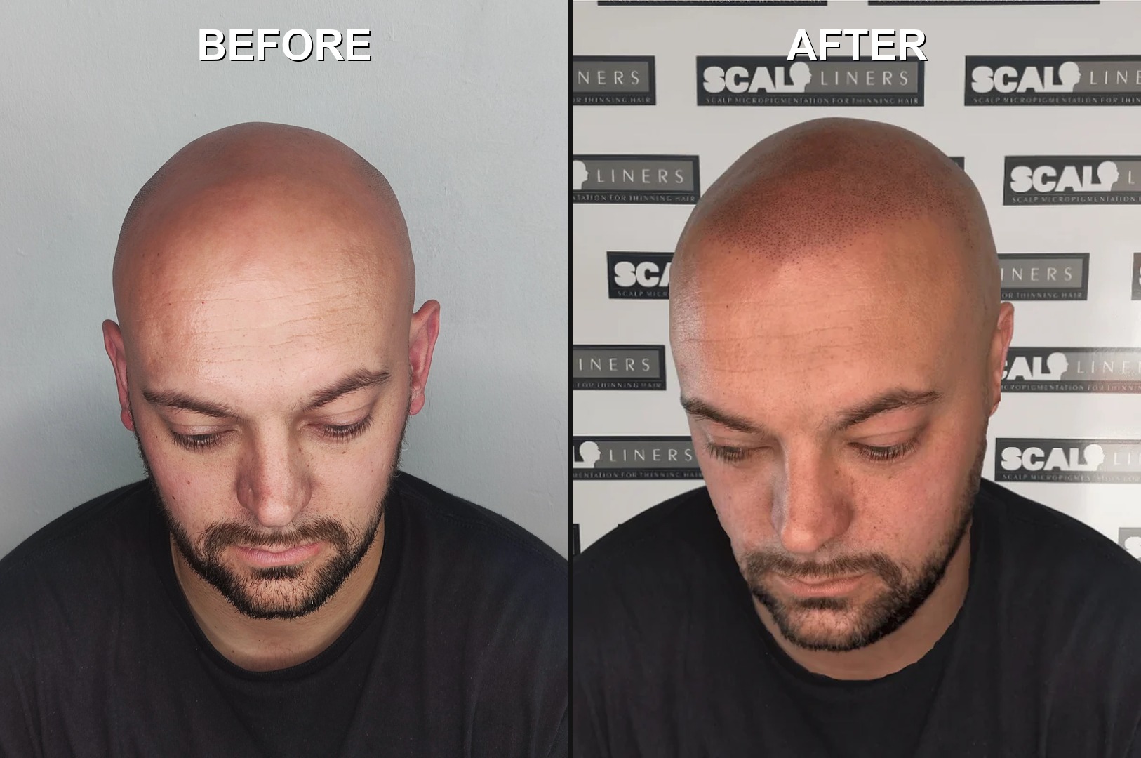 Logo of ScalpLiners Scalp Micropigmentation