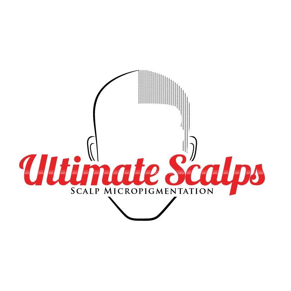 Logo of Ultimate Scalps Hair Replacement Service In Liverpool, Merseyside