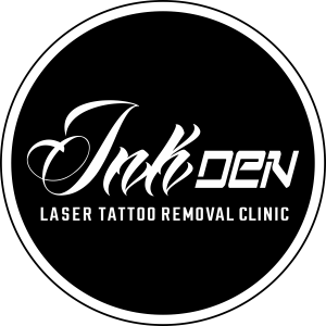 Logo of Inkden Laser Tattoo Removal Clinic Tattoo Removal In Blackpool, Lancashire