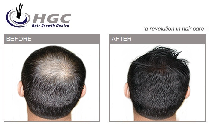 Logo of Hair Growth Centre